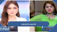 صور ياسمين عز قبل وبعد التجميل