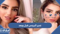 غدير البرجس قبل وبعد التجميل