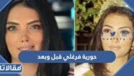 حورية فرغلي قبل وبعد