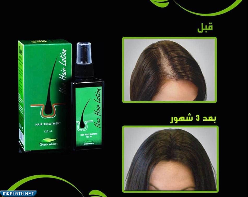 تجربتي مع نيو هير لوشن neo hair lotion للشعر