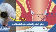 طرق مجربة لعلاج الشرخ المزمن جابر القحطاني