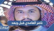المذيع السعودي ناصر الغامدي قبل وبعد بالصور